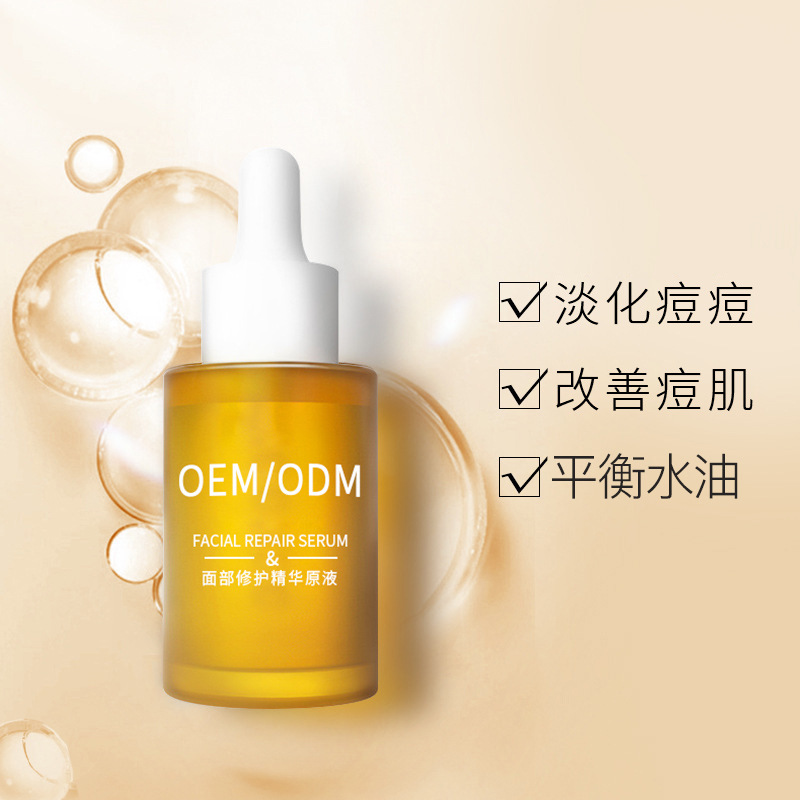 厦门市_祛痘精华原液OEM